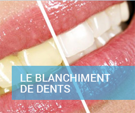 Dentiste Djerba Blanchiment