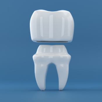 Couronnes dentaires : protégez et restaurez vos dents durablement